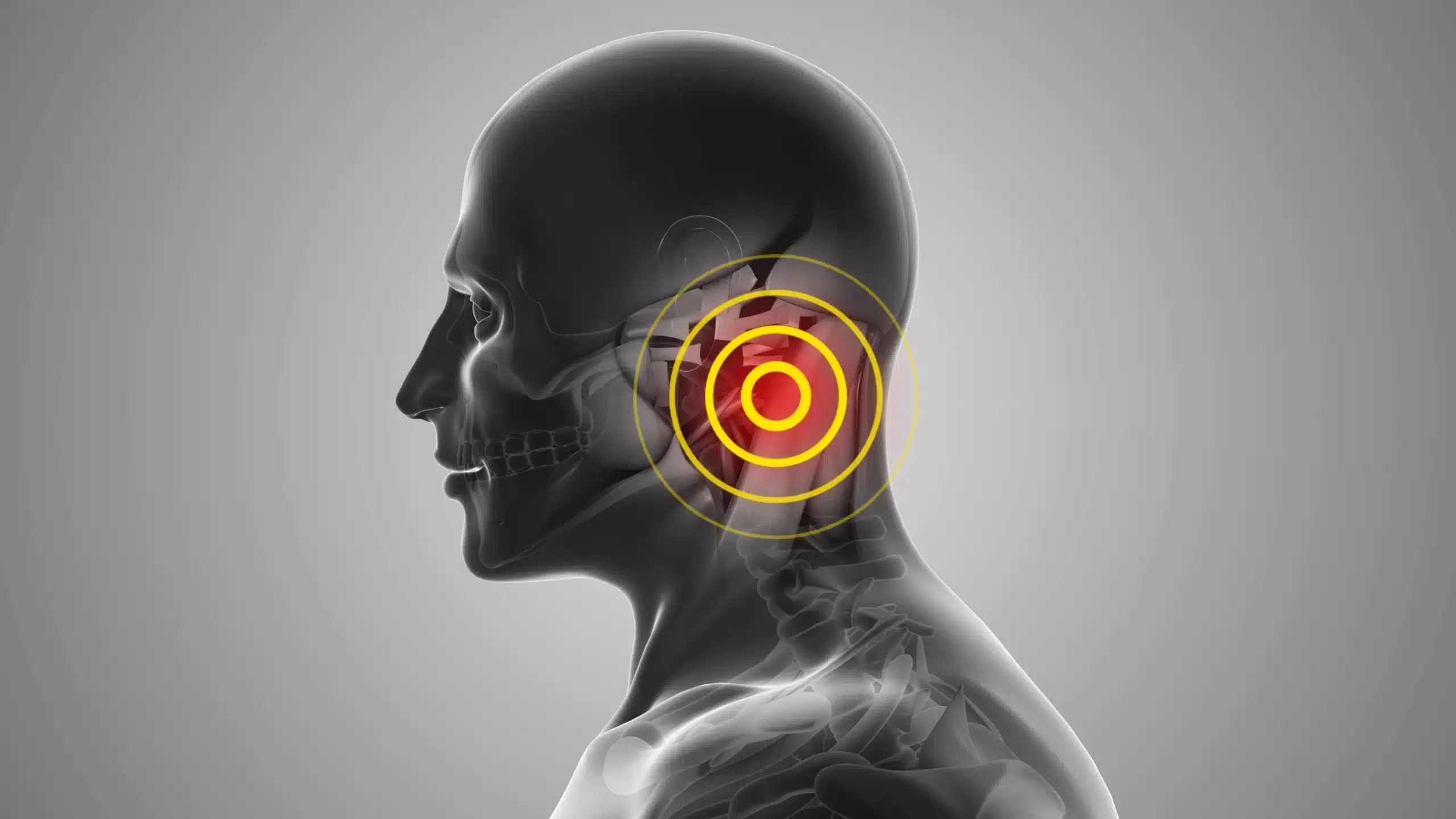Acouphene : Comprendre les Symptômes et Causes